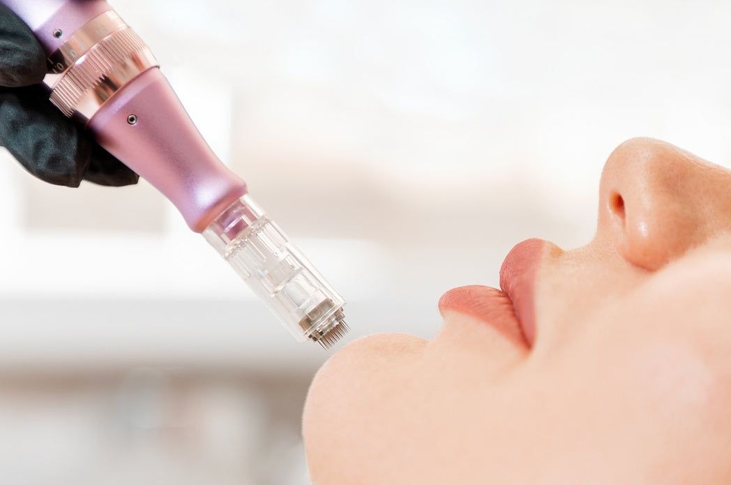 Microneedling Dermapen | Rejuvenecimiento Facial